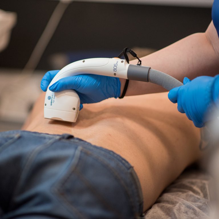 Depilacja laserowa LightSheer - VS Akademia Urody Łódż Złotno 7