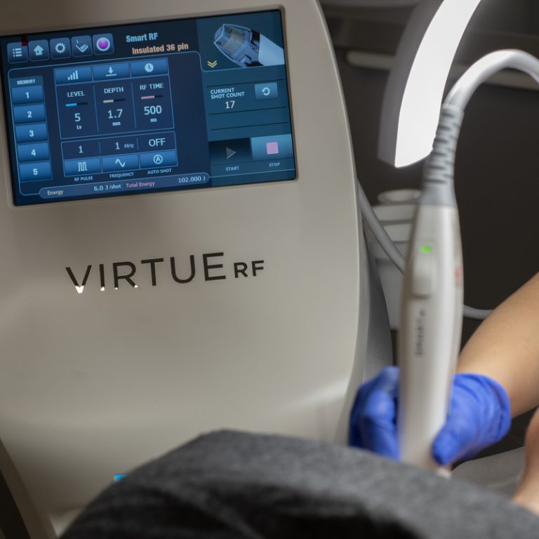 Kosmetologia estetyczna - zabieg Radiofrekwencji Virtue RF - Vs Akademia Urody Łódź Złotno